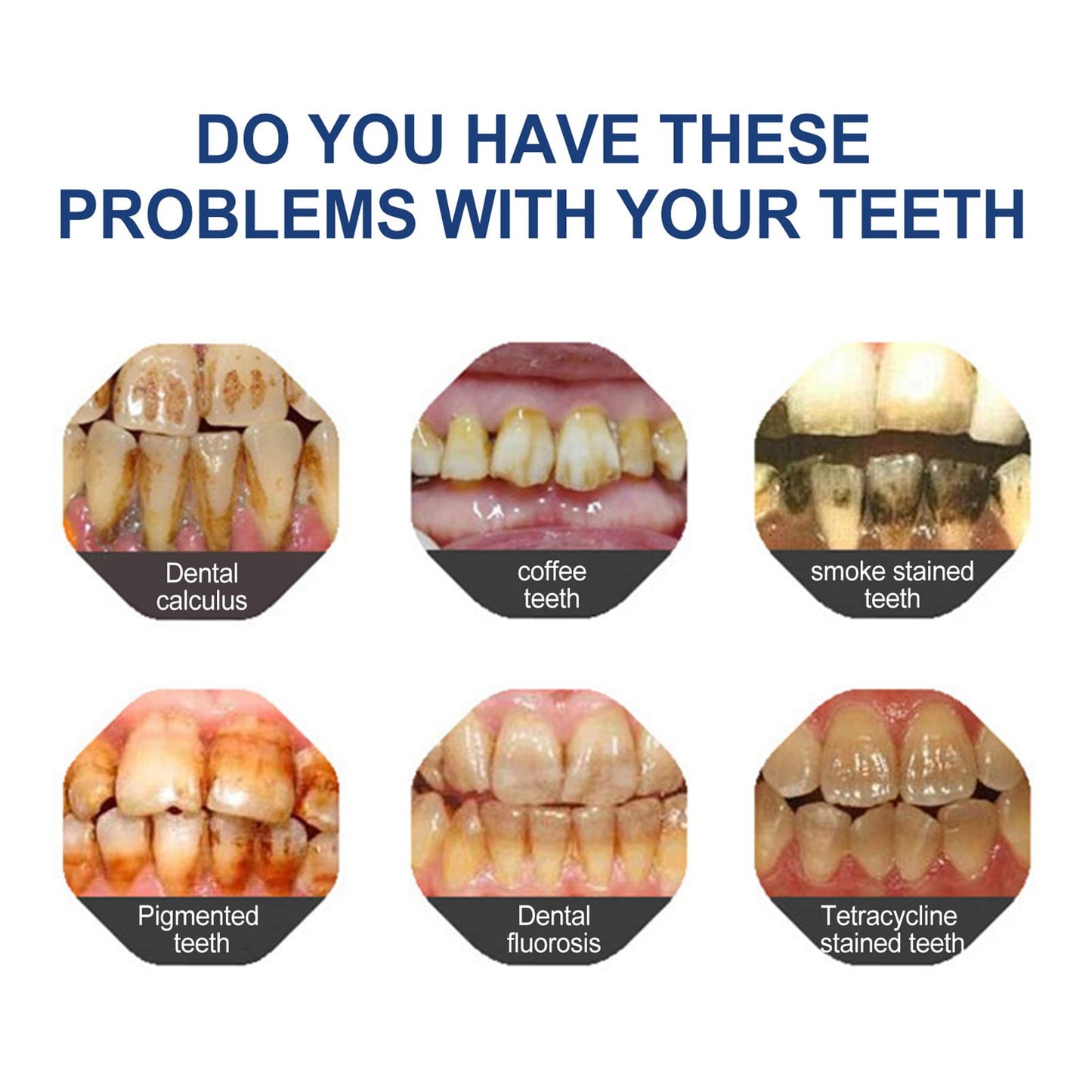 Fluoride-Free Hydroxyapatite Toothpaste