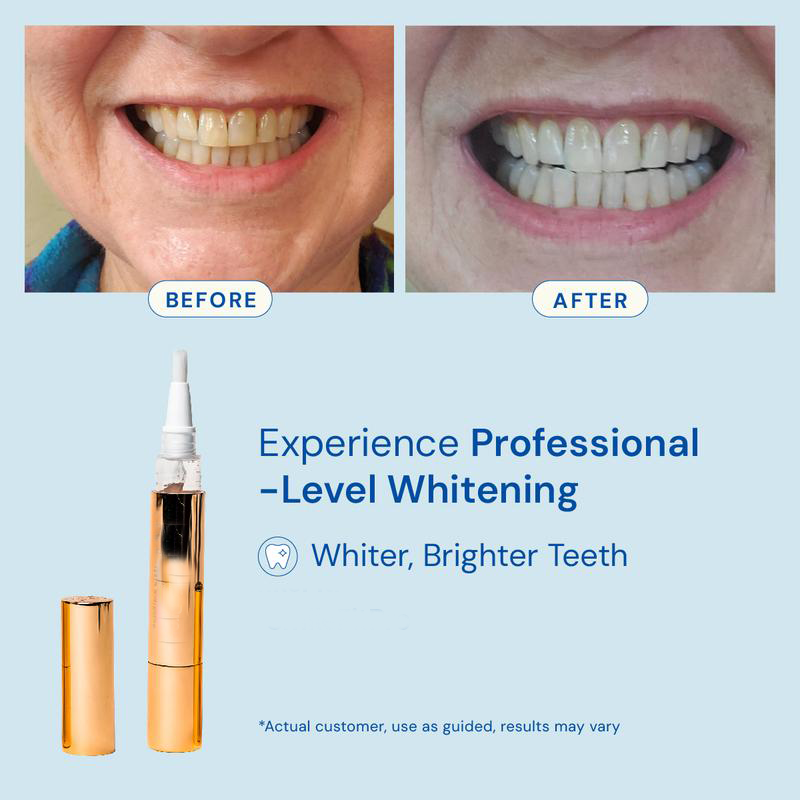 BrightStick™ Teeth Whitening Stick