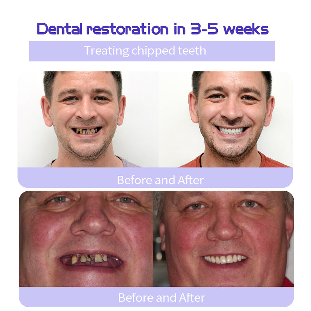 Fluoride-Free Hydroxyapatite Toothpaste