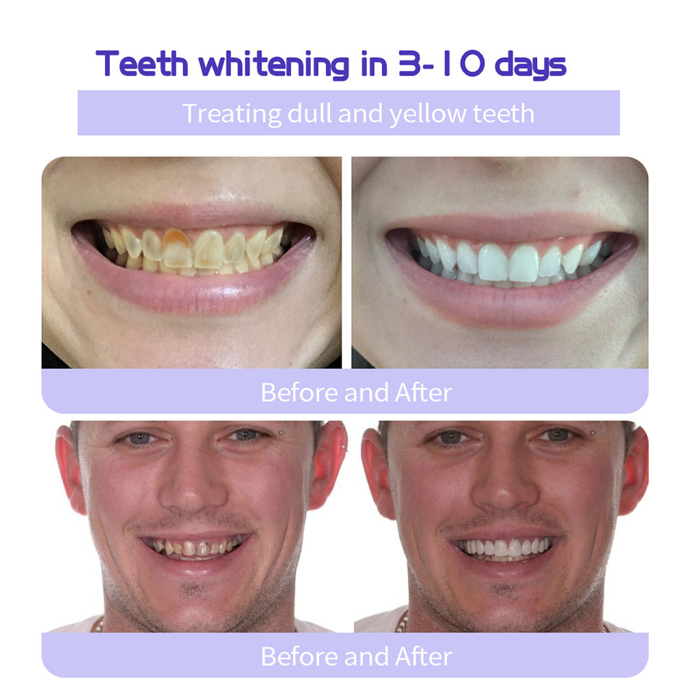 Fluoride-Free Hydroxyapatite Toothpaste