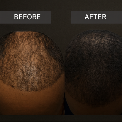 FadeAway Hair Concealer