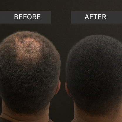 FadeAway Hair Concealer