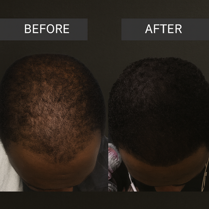 FadeAway Hair Concealer